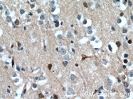 10214-1-Ig - TSC22D1