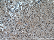 10214-1-Ig - TSC22D1