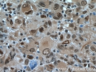 10214-1-Ig - TSC22D1