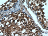 10214-1-Ig - TSC22D1