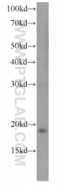 10214-1-Ig - TSC22D1