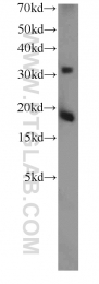 10214-1-Ig - TSC22D1