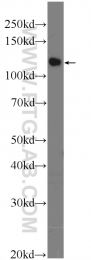 25418-1-AP - TSC22D2