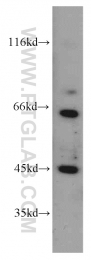 55017-1-AP - TSC22D4