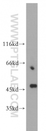 14497-1-AP - TSG101
