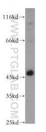 14497-1-AP - TSG101