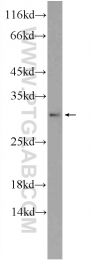 55426-1-AP - Translin (TSN)