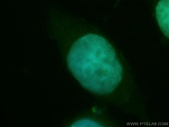 12087-2-AP - TSPYL2