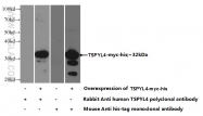 17576-1-AP - TSPYL4