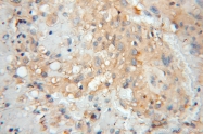 11891-1-AP - Transthyretin / Prealbumin