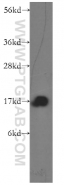 11891-1-AP - Transthyretin / Prealbumin