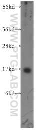 11891-1-AP - Transthyretin / Prealbumin