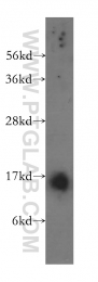 11891-1-AP - Transthyretin / Prealbumin