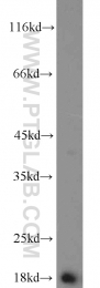 11891-1-AP - Transthyretin / Prealbumin