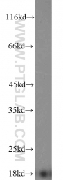 11891-1-AP - Transthyretin / Prealbumin