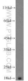 11891-1-AP - Transthyretin / Prealbumin