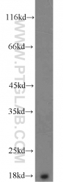 11891-1-AP - Transthyretin / Prealbumin