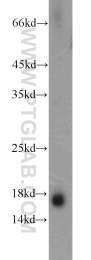 11891-1-AP - Transthyretin / Prealbumin