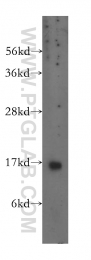 11891-1-AP - Transthyretin / Prealbumin