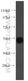 10759-1-AP - alpha Tubulin / TUBA4A / TUBA1