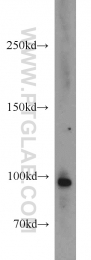 15719-1-AP - TUBGCP3