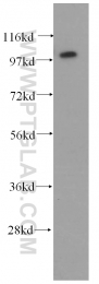 15719-1-AP - TUBGCP3