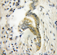 11732-1-AP - Twinfilin-1 (TWF1)