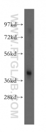 11732-1-AP - Twinfilin-1 (TWF1)