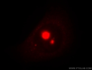 18981-1-AP - TXK / PTK4