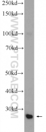 25208-1-AP - TXNDC9 / APACD