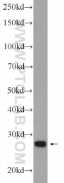 25208-1-AP - TXNDC9 / APACD