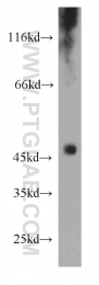 18243-1-AP - TXNIP / VDUP1