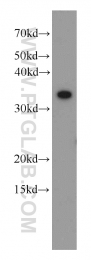 15289-1-AP - TXNL1
