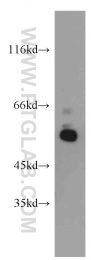 12385-1-AP - UBAP1 / NAG20