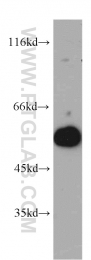 12385-1-AP - UBAP1 / NAG20