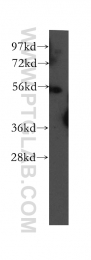 12385-1-AP - UBAP1 / NAG20