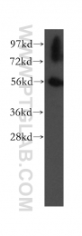 12385-1-AP - UBAP1 / NAG20