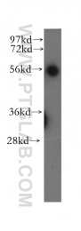 12385-1-AP - UBAP1 / NAG20