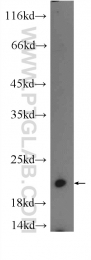 14520-1-AP - UBE2M