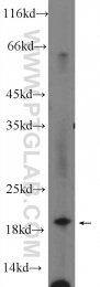 14520-1-AP - UBE2M