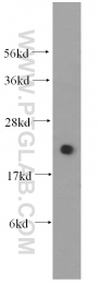 10224-1-AP - UBC9 / UBE2I