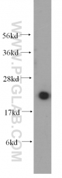 10224-1-AP - UBC9 / UBE2I