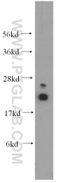 10224-1-AP - UBC9 / UBE2I