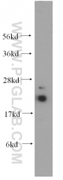10224-1-AP - UBC9 / UBE2I