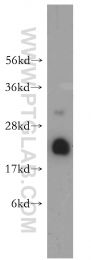 10224-1-AP - UBC9 / UBE2I