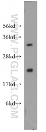10224-1-AP - UBC9 / UBE2I