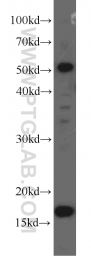 60201-1-Ig - UBC9 / UBE2I