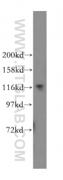 15912-1-AP - UBE1 / UBA1
