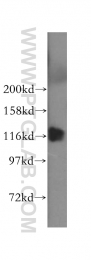 15912-1-AP - UBE1 / UBA1
