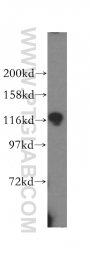 15912-1-AP - UBE1 / UBA1